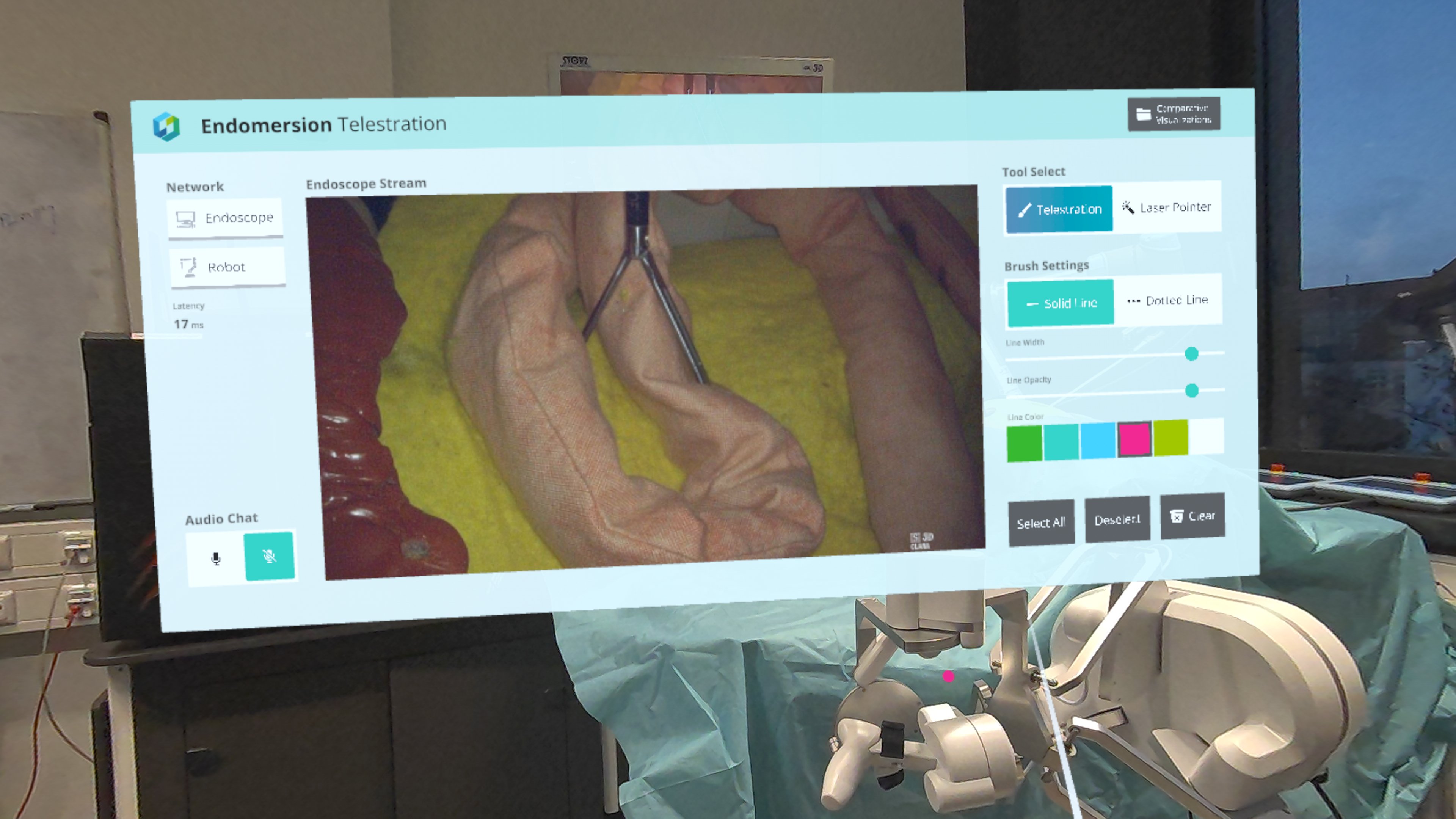 Endomersion immersive 3D visualization through Meta Quest headset